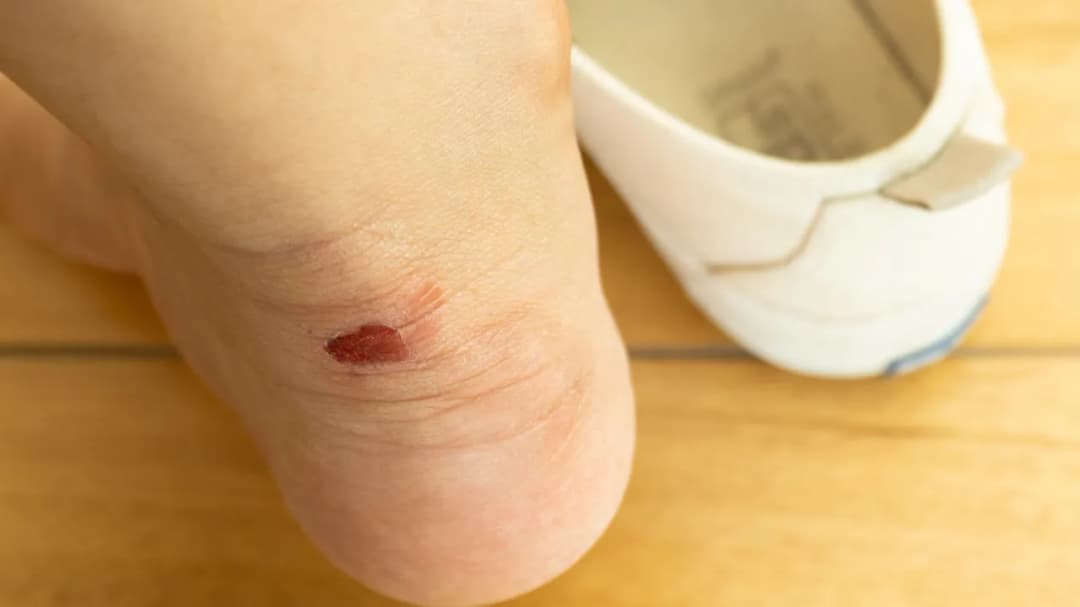 Dlaczego nowe buty obcierają i jak uniknąć bolesnych odcisków